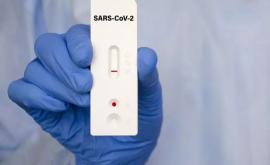 В лабораторию НАОЗ поступили еще 100 000 экспресстестов для выявления SARSCoV2
