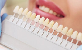 Adevărul despre albirea dinților de la bicarbonat de sodiu la lămîi 