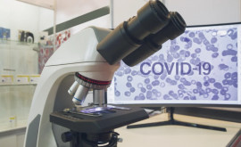 Хорошая новость Тесты на COVID19 станут дешевле 