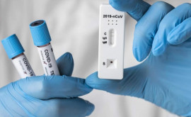 Ceban către Ministerul Sănătății Unde pot fi realizate testele PCR la prețul de 300 de lei