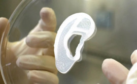 Implant de ureche imprimată 3D pe bază de celule umane realizat în Statele Unite