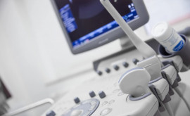 Spitalul din Rîșcani are un aparat nou de ultrasonografie