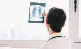Servicii gratuite de screening pulmonar întrun raion din țară