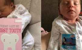 O fetiță sa născut cu un dinte iar la 12 zile a ajuns la stomatolog