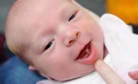 Un copil sa născut cu un dinte de lapte 