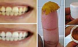 Fii tu propriul tău dentist Îndepărtați cariile dentare inflamația gingiilor și înălbițivă dinții cu această pastă de dinți naturală