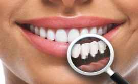 În ce situații nu este posibil implantul dentar