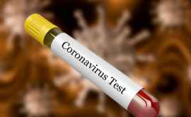 Минздрав предупреждает население о фальшивых тестах на коронавирус