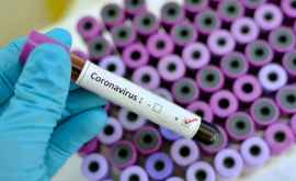 Dodon Nu avem niciun caz de refuz de testare a persoanelor suspecte de coronavirus