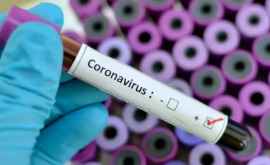 В Центре размещения в селе Бэдичень подтверждены 65 случаев коронавируса