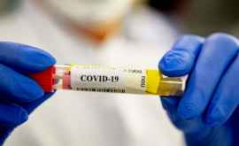 În Moldova au fost aprobate primele studii clinice pentru tratamentul Covid19