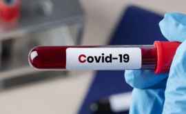 Молдова закупит еще 100 тысяч тестов для диагностики COVID19