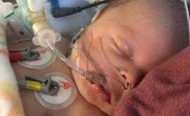 Un bebeluș a făcut trei stopuri cardiorespiratorii