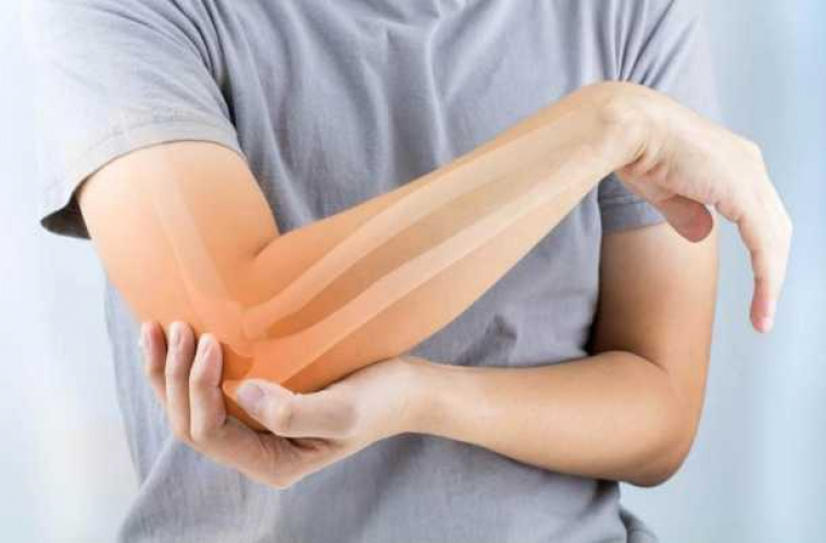 Totul despre artrita genunchiului - Simptome, tipuri, tratament | barbering.ro