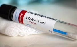 Цены на услуги диагностики COVID19 будут регулироваться