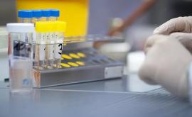 Franța introduce un protocol special împotriva tulpinii britanice a coronavirusului