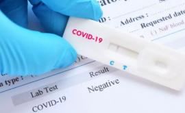 В Молдове зарегистрировали 377 новых случаев COVID19