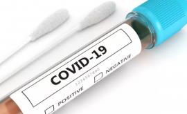 363 cazuri de COVID19 înregistrate în ultimele 24 ore
