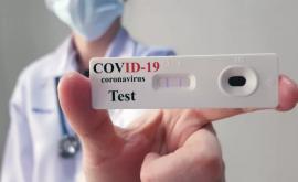 În instituțiile medicale din țară au fost repartizate 100000 de teste rapide antigen SARSCoV2