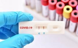 Больницы и поликлиники Молдовы получат еще 100 тыс экспресстестов на COVID19