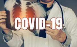 В Молдове за 24 часа подтвердили 380 новых случаев COVID19