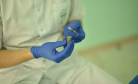 Etapele realizării unui implant dentar curiozități și lucruri de știut