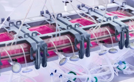 Elveţia a dezvoltat primul aparat care produce piele pentru transplanturi