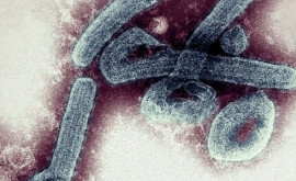 Похожий на Эболу В Гвинее появился еще один смертельный вирус