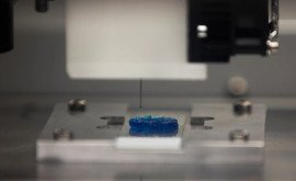 Un model bioprintat 3D al unei tumori creat de o echipă de cercetători israelieni