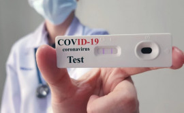 376 новых случаев заражения COVID19 выявлены за последние сутки