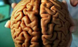 Почему уменьшается головной мозг