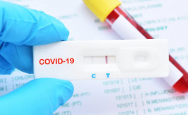 Teste gratuite pentru cadrele didactice nevaccinate din Chișinău