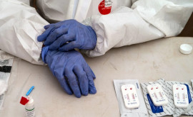 În Moldova se propune vînzarea testelor rapide în farmacii