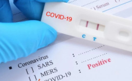 Certificatul COVID19 poate fi obținut doar în baza testului de laborator