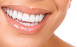 5 sfaturi pentru a proteja dinții de carii