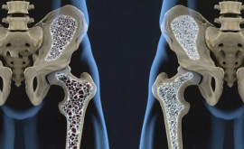 Ученые научились выращивать электронные устройства на костях человека Они помогут следить за состоянием здоровья