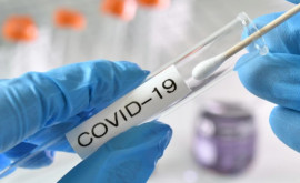 1858 cazuri noi de infectare cu COVID19 au fost confirmate astăzi în Moldova