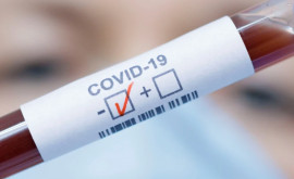 Ещё 3927 новых случаев заражения COVID19 подтверждены за прошедшие сутки