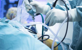 Выдающееся достижение команда молдавских врачей реплантировала ампутированную руку пациенту