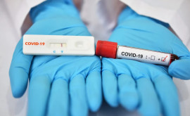 Cazurile de coronavirus în R Moldova întro creștere ușoară