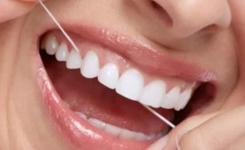 Medicii au creat o ață dentară unică