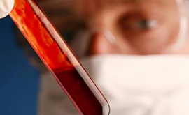 Важное открытие Анализ крови может показать за год появление рака