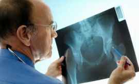 5 природных средств для борьбы с остеопорозом