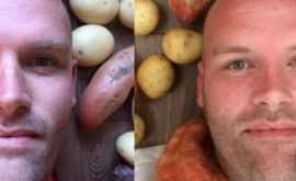 Un bărbat a mîncat doar cartofi timp de un an ce a păţit