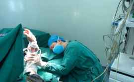 Хирург уснул у стола с пациентом после 20часовой операции
