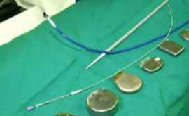 Самый маленький в мире кардиостимулятор был вживлен хорватскими врачами