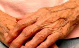 Женщина прожила 99 лет с редкой формой заболевания