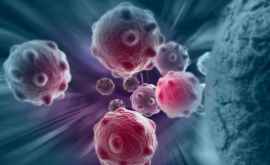 Microgravitația ar putea ucide celule canceroase