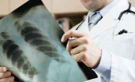 В столице зафиксировано 12 новых случаев туберкулеза