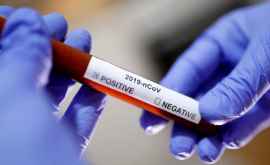 100 de mii de teste și 5 laboratoare Petiție la Guvern pentru oprirea epidemiei